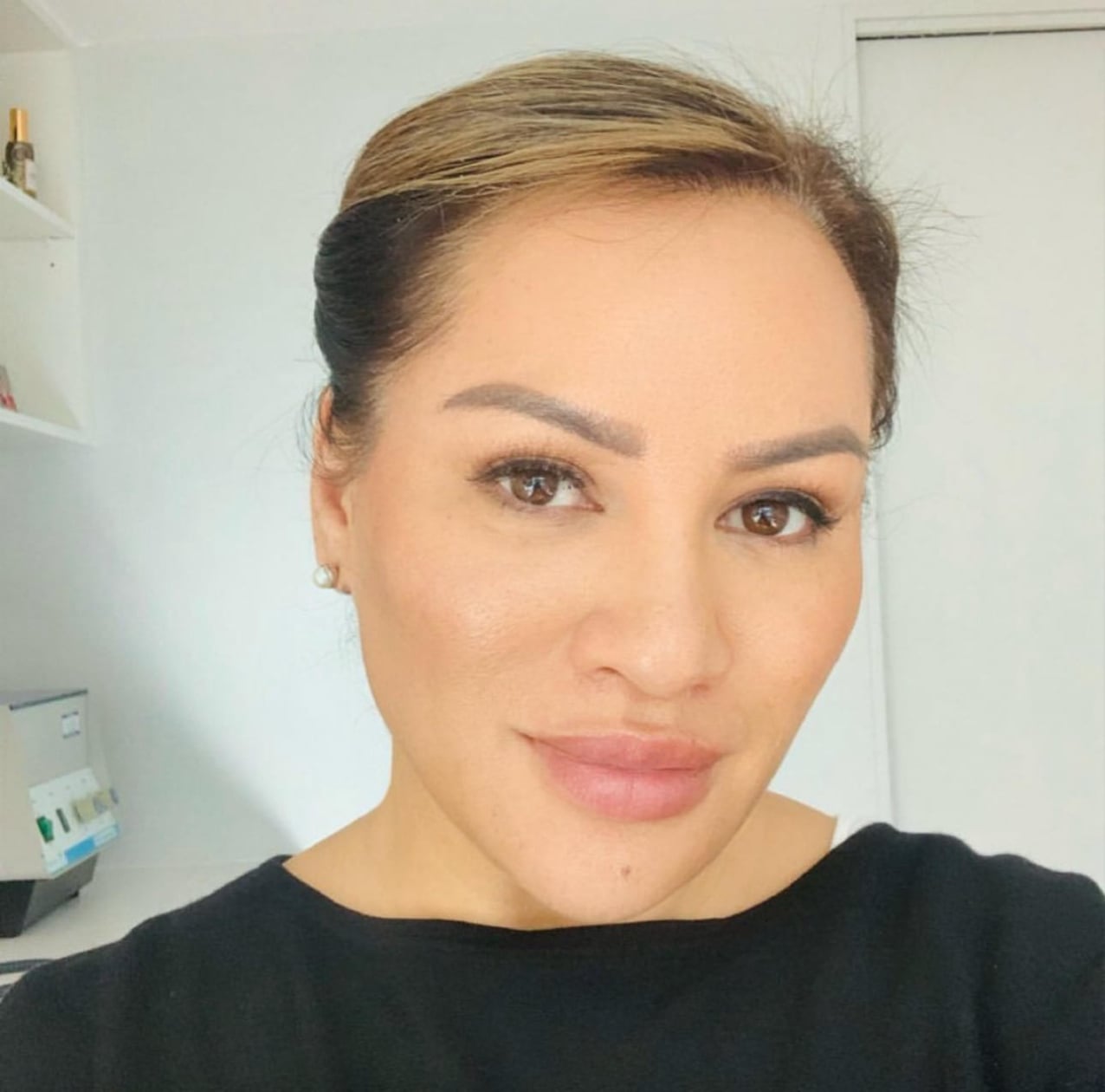 Cosmetic injections near me